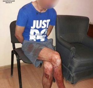 В Ужгороді патрульні затримали ймовірного вбивцю