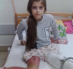 Винним у каліцтві ужгородської школярки Аніти Білей суд призначив 11900 гривень штрафу