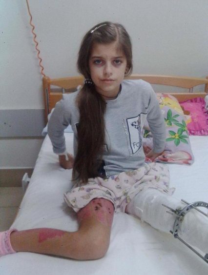 Сьогодні відбудеться суд у справі про скалічення ужгородськими комунальниками Анітки Білей