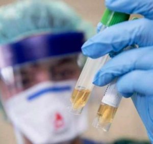 Ситуація щодо COVID-19 на Закарпатті станом на 10 годину 7 квітня